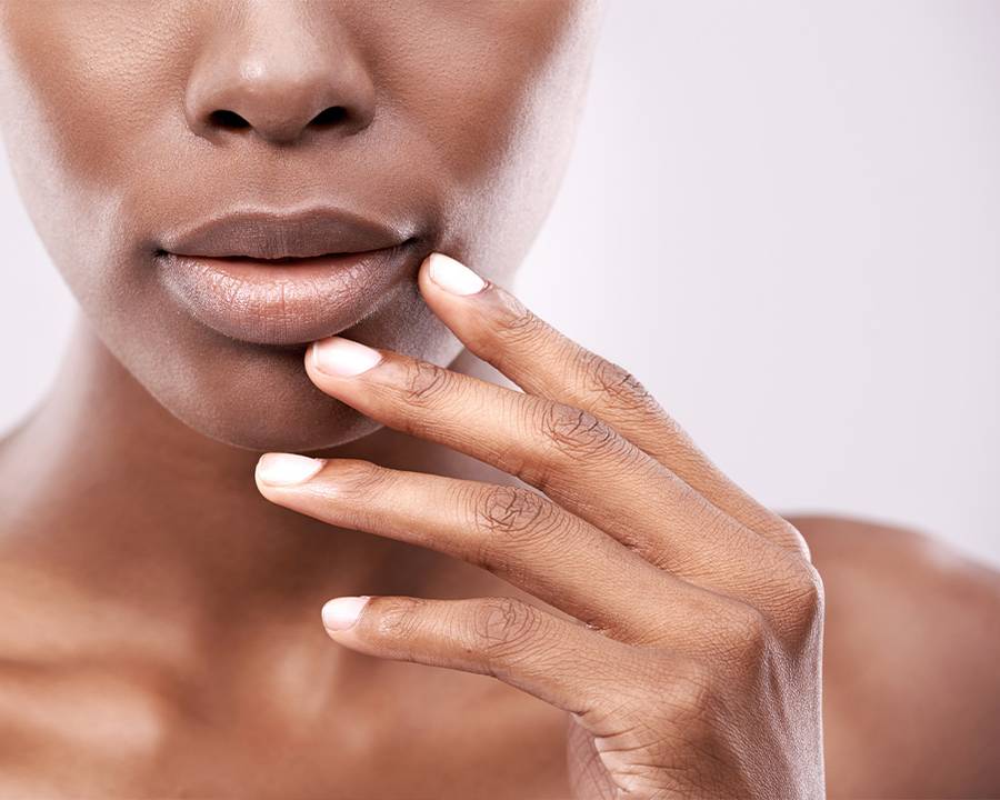 How to Alleviate and Prevent Cold Sores, According to Experts