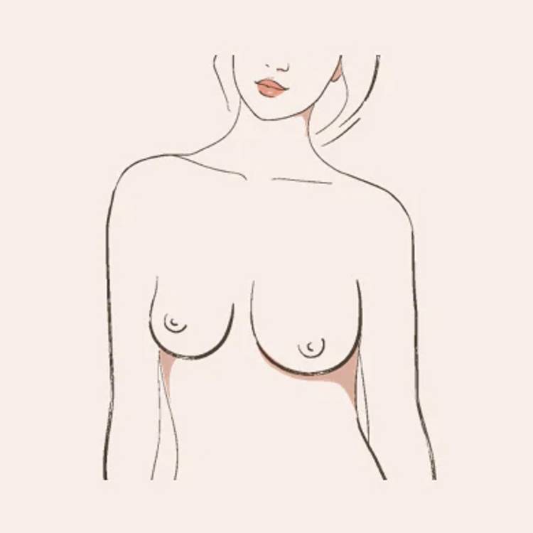 asymmetric breasts