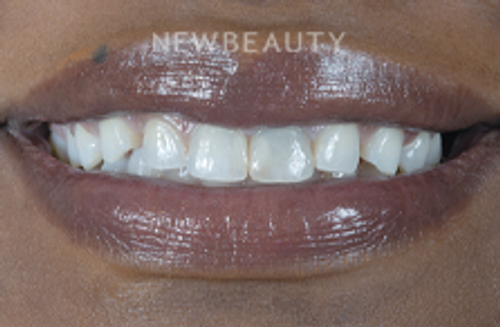 Dr. Robert Klaich - Stunning Transformation - 22247240 - Before