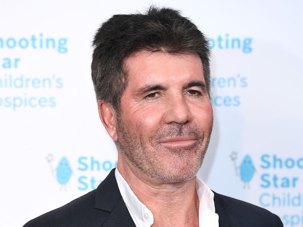 Simon Cowell Says He Didn’t Recognize Himself After Too Much Filler