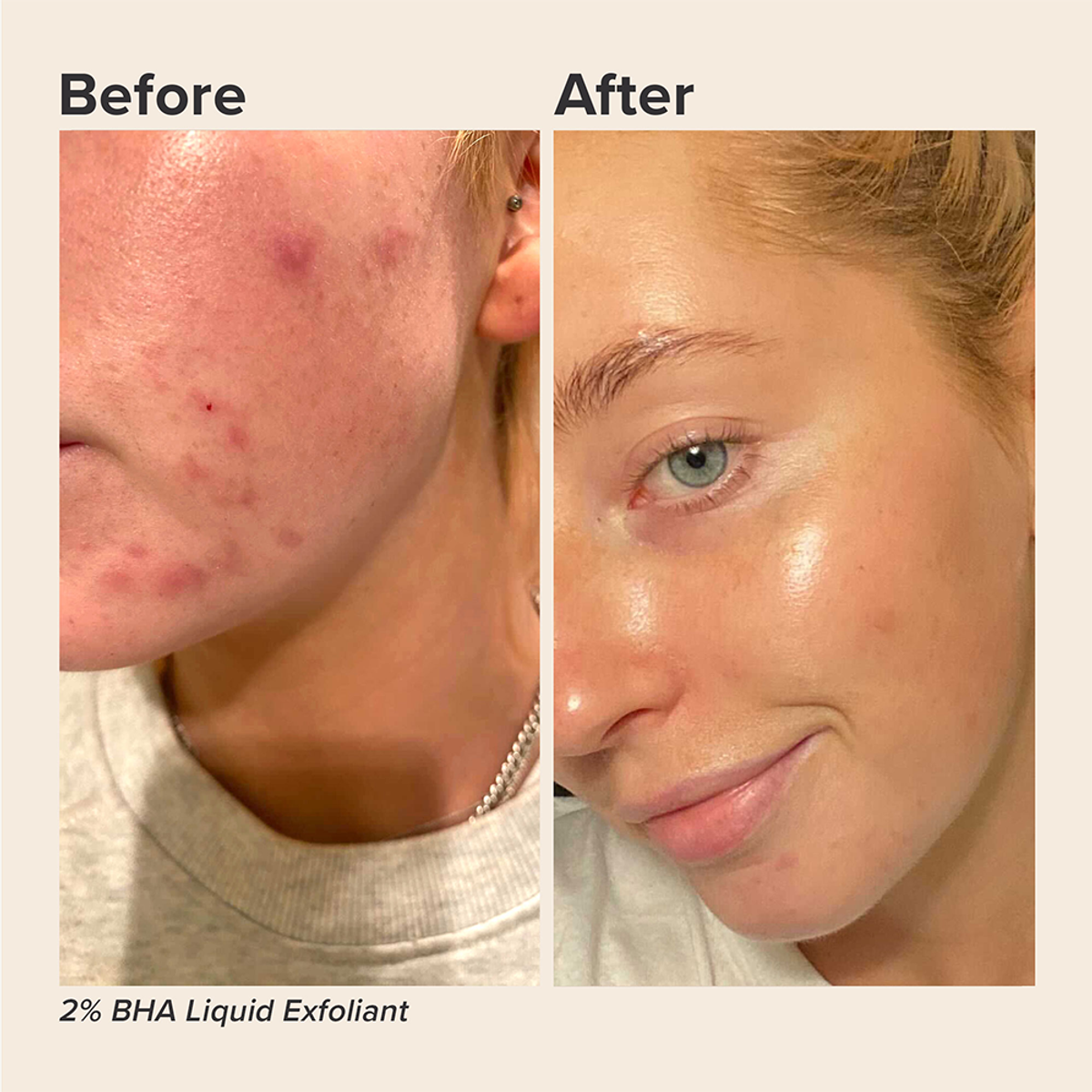 CLINICAL PRO Retinaldehyde Dual-Retinoid Treatment