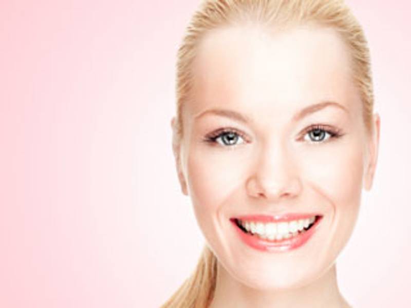 veneers-fi