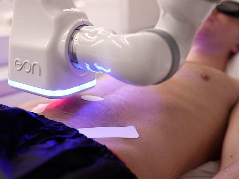 The 30-Minute Fat-Reducing Treatment Coming to a Department Store Near You This Fall