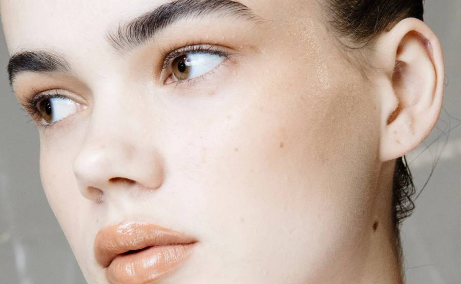uneven skin texture