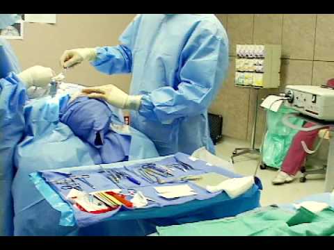 Dr. Karam My Nose Job Surgery – Dr. Amir Karam & San Diego Rhinoplasty