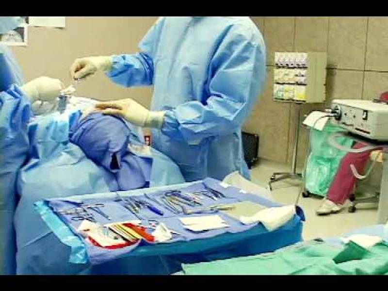Dr. Karam My Nose Job Surgery – Dr. Amir Karam & San Diego Rhinoplasty