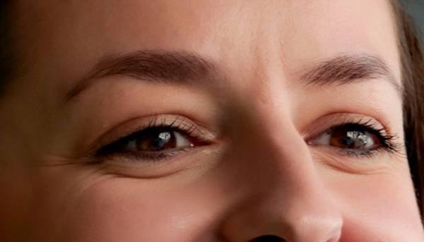 woman's forehead