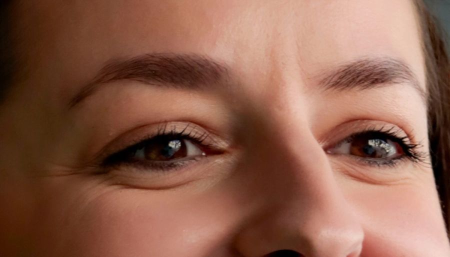 woman's forehead