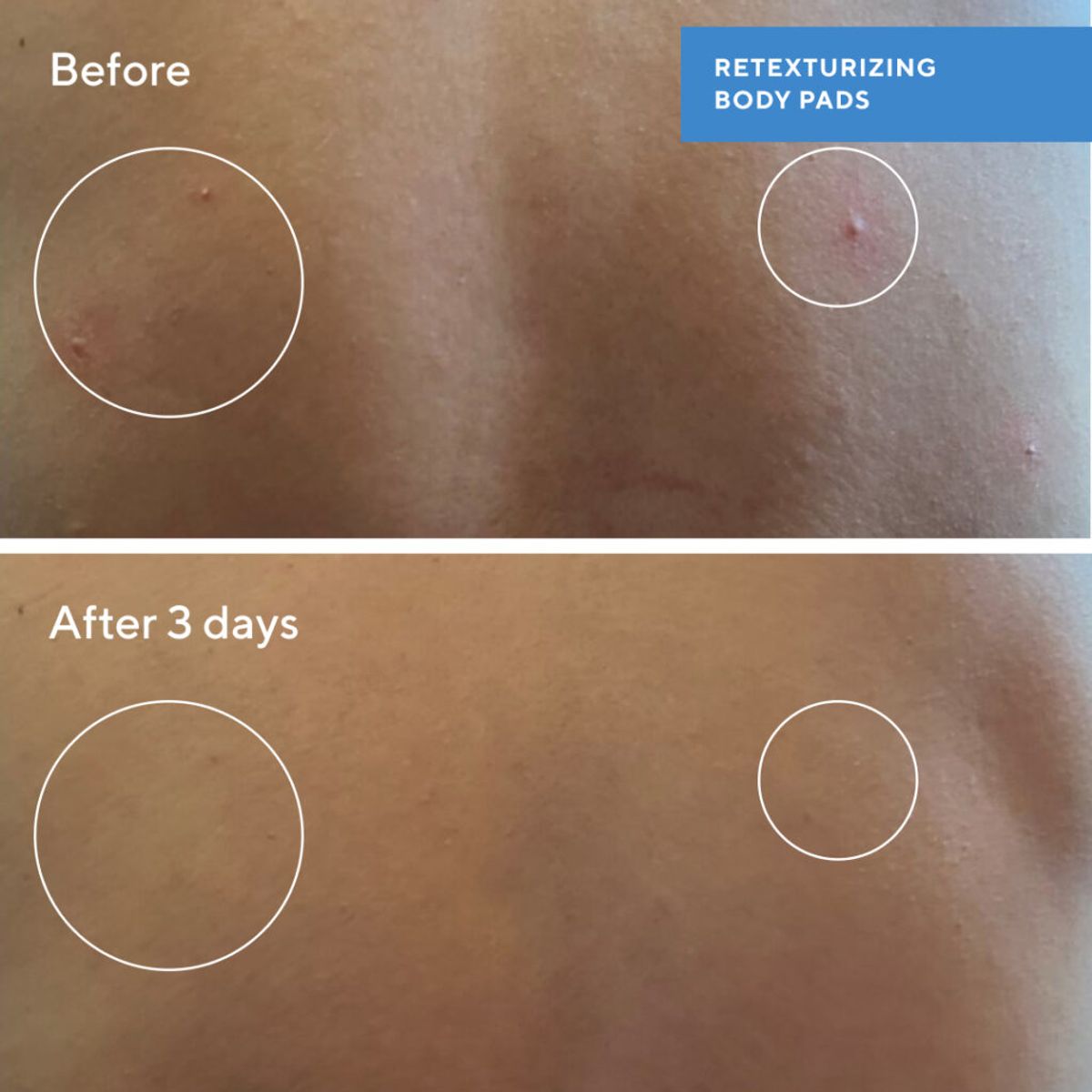 Before and After Murad Retexturizing Pads