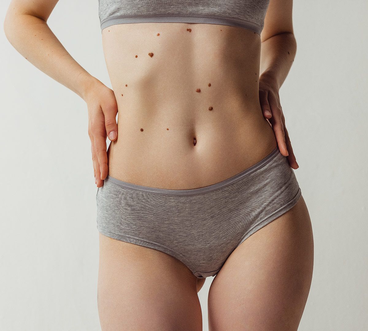 Award Photo: Emsculpt NEO