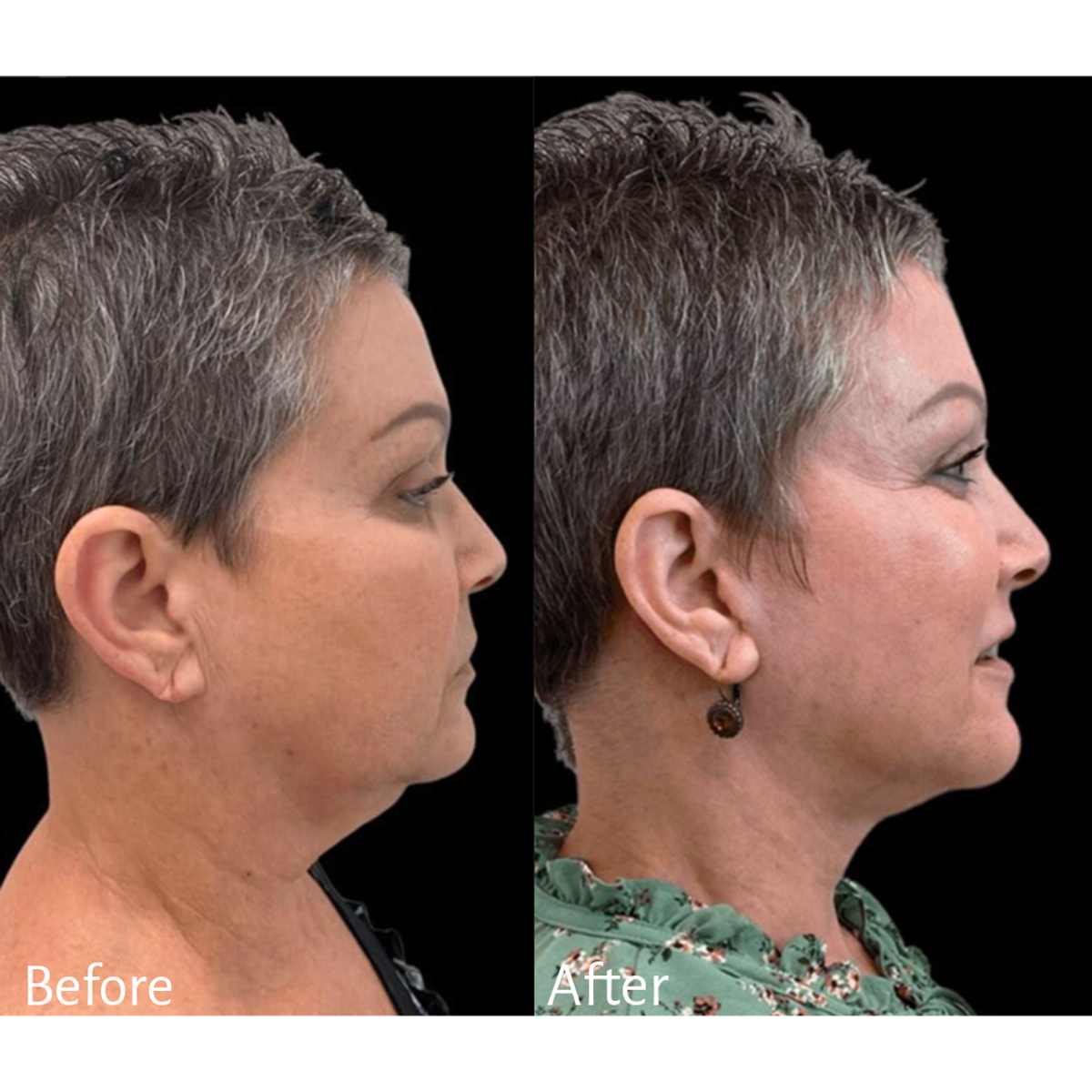 Dr. Daniel Crane before and after