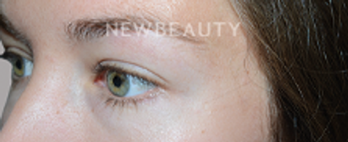 Dr. Jeffrey Epstein - Defined Brows - 44714704 - Before