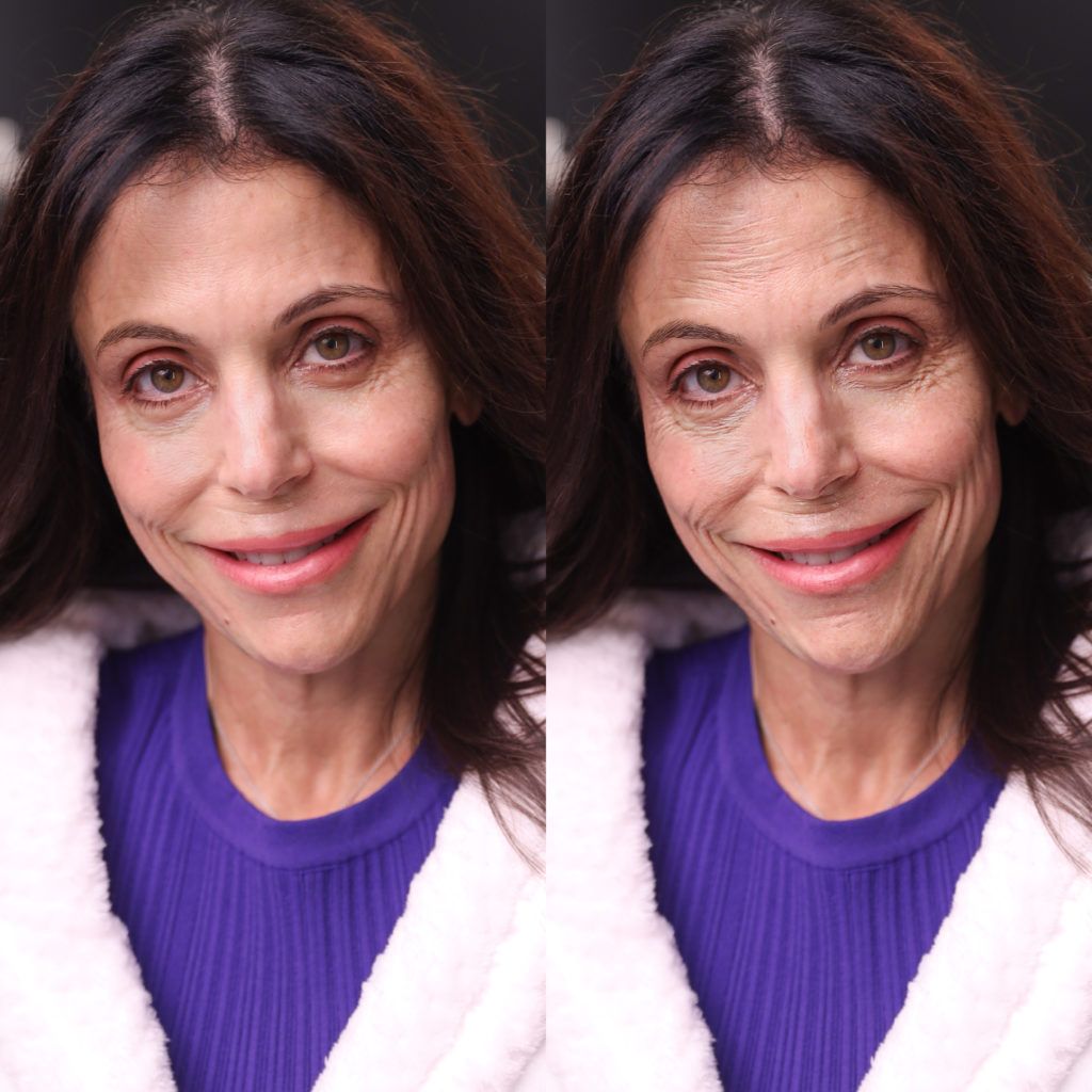 Bethenny Frankel B&A (1)