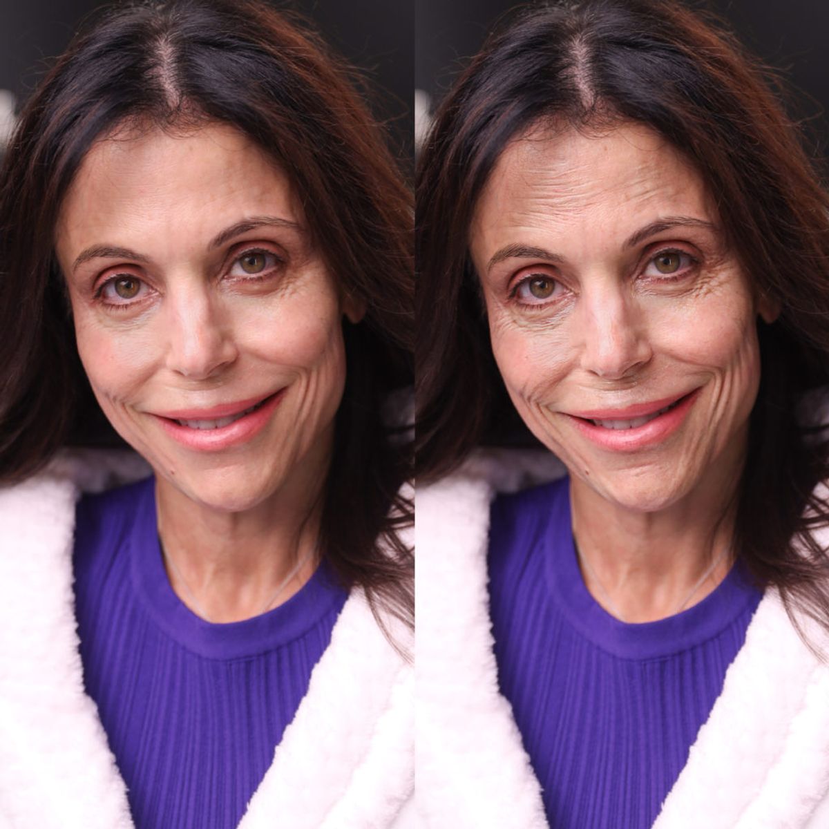 Bethenny Frankel B&A (1)