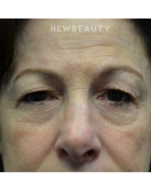 Dr. B. Aviva Preminger - Youthful Look - Before