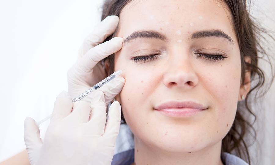 Anti-aging method combating deep facial lines and wrinkles.