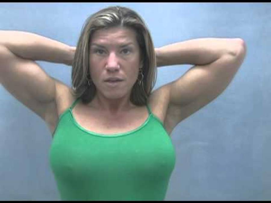Jen’s “One – Day Recovery” breast augmentation: 24 hours later
