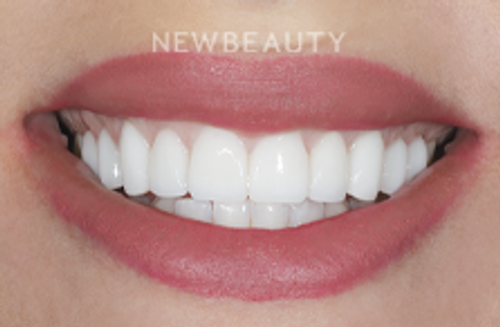Dr. Brian Klaich - Beautiful Restoration - 22247129 - After