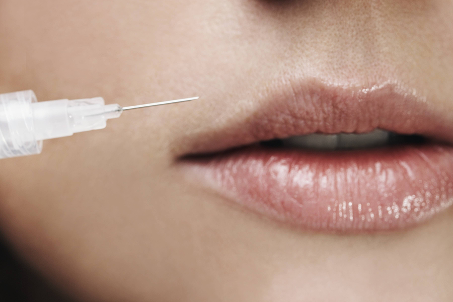 hyaluronic acid filler