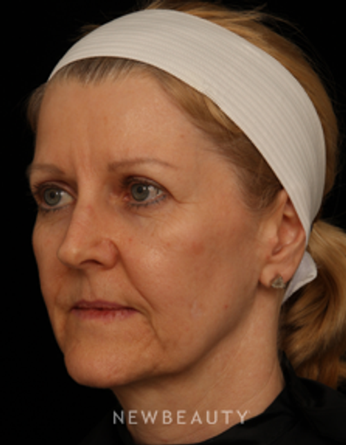 Dr. Jennifer Segal - Reason to Smile - Before