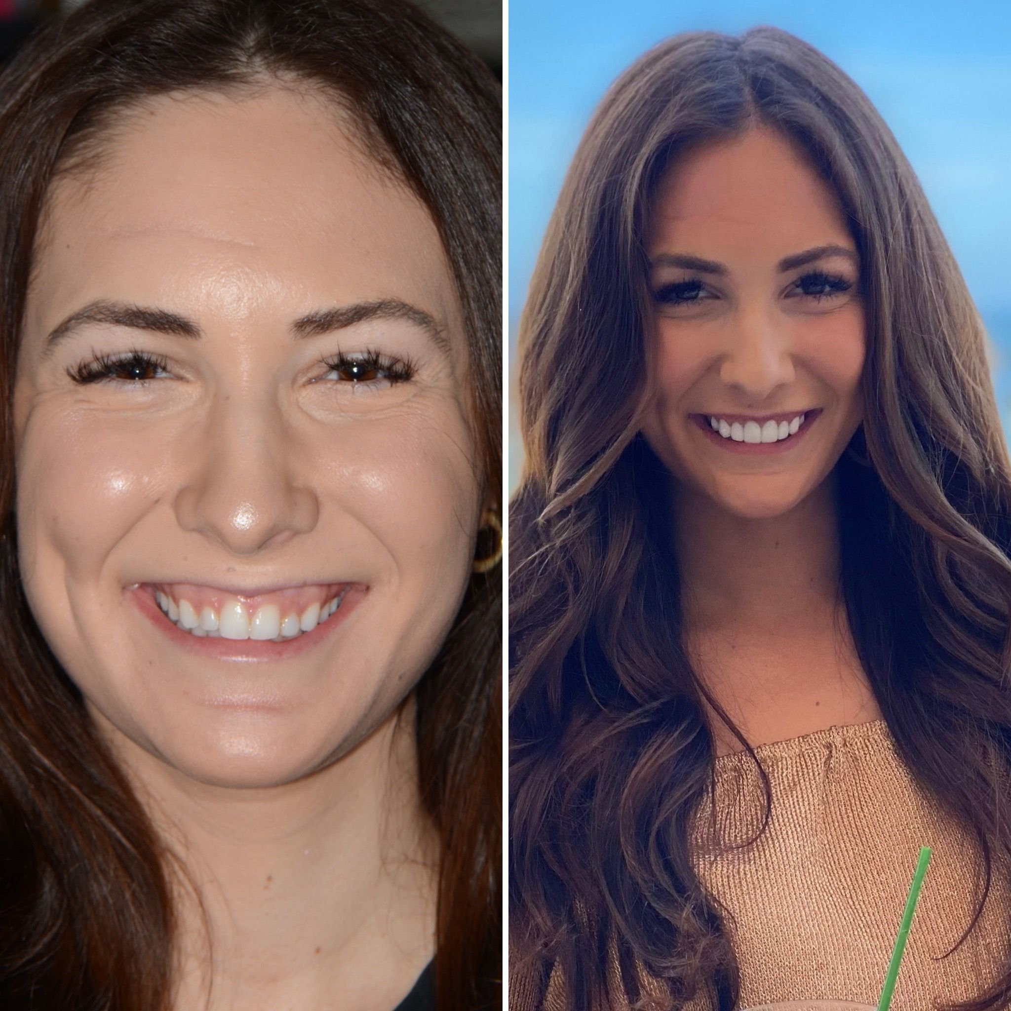 The Compliment Collector