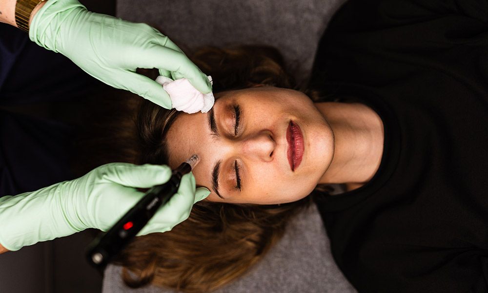 Top view of a woman receiving facial beauty treatment with Dermapen