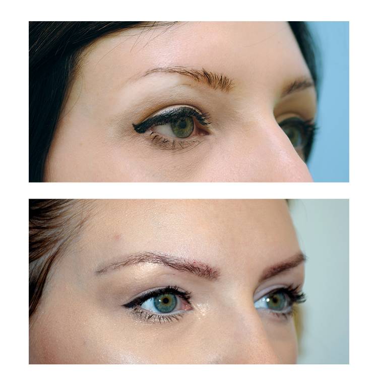 5 Proven Ways to Improve Thin Eyebrows | NewBeauty