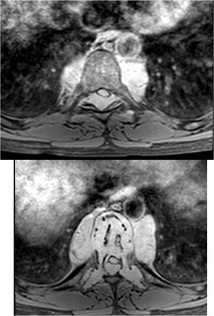 Functional Foods: Which health-related claims are hits with consumers?