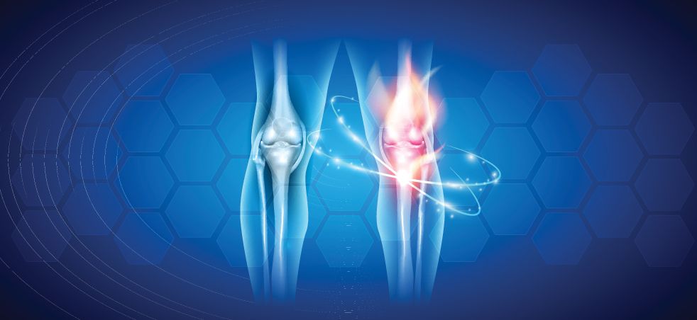 Flex time: Joint health supplements are more popular than ever