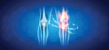 Flex time: Joint health supplements are more popular than ever