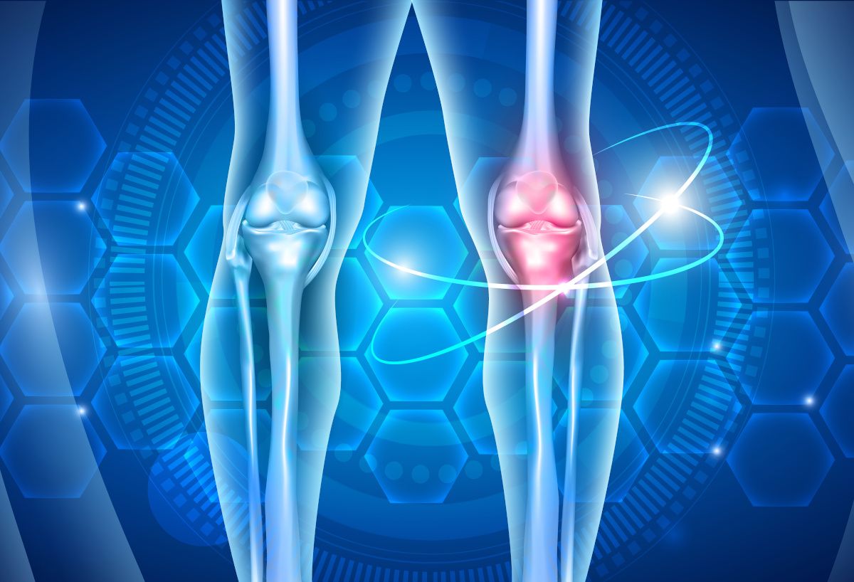 illustration of x-rayed knees depicting joint pain