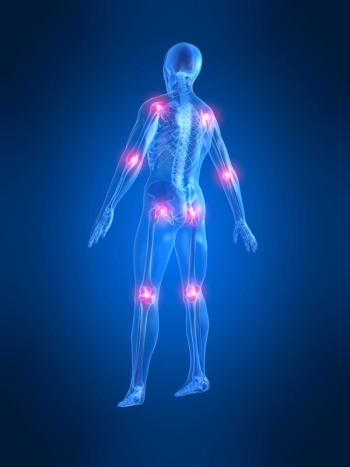 Bone health supplements for aging consumers are evolving