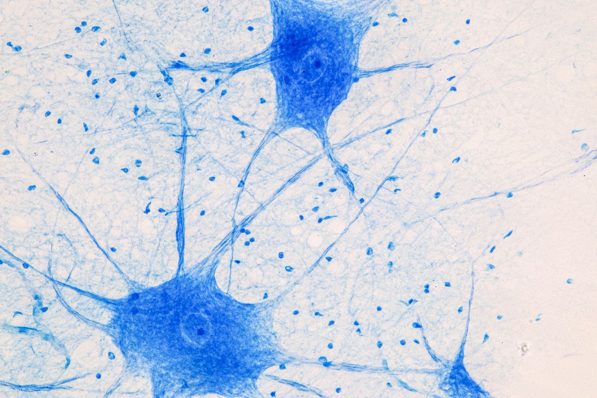 neurons under microscope