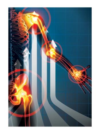 Research skyrockets on natural ingredients for joint health