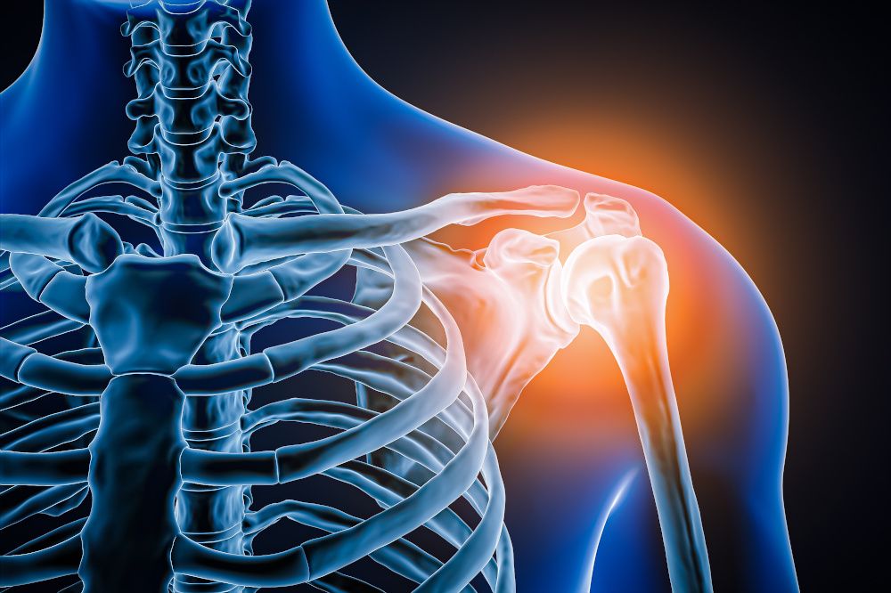 Who are today’s key joint health customers?