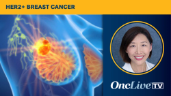 Dr Yuan on Intracranial Activity With T-DXd Plus Pertuzumab in HER2+ Metastatic Breast Cancer