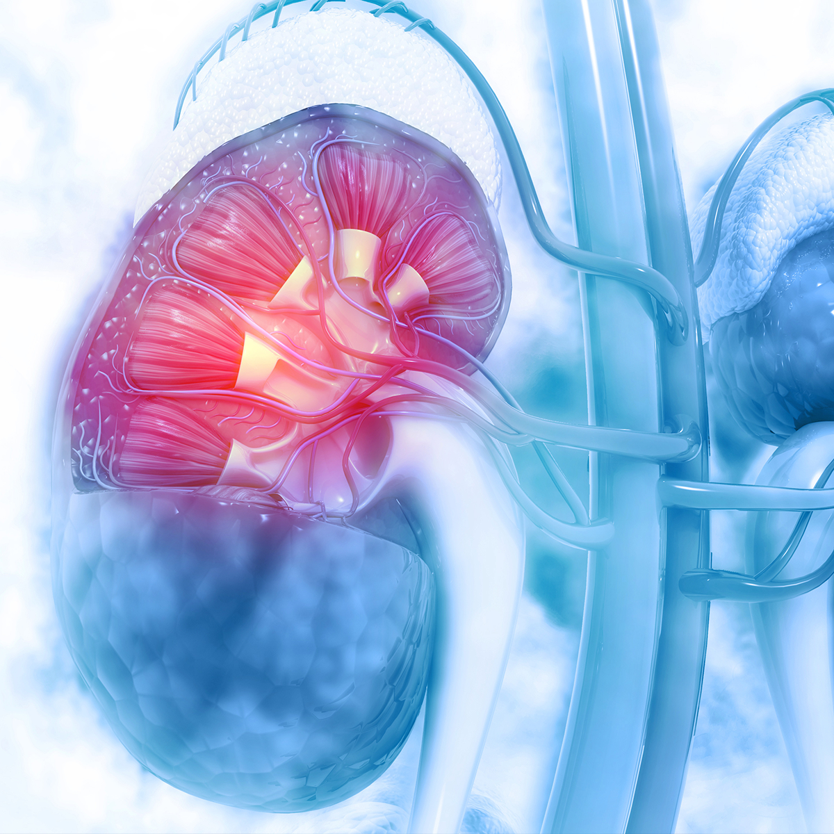 renal cell carcinoma