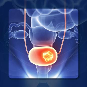 NMIBC | Image credit:  © Sebastian Kaulitzki - stock.adobe.com