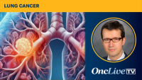 Divarasib Plus Pembrolizumab in KRAS G12C–Mutated NSCLC | Image Credit: © Ashling Wahner & MJH Life Sciences Using AI