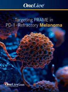Targeting PRAME in PD-1–Refractory Melanoma