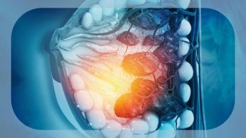 HER2+ Breast Cancer   | Image Credit: © Rasi - stock.adobe.com