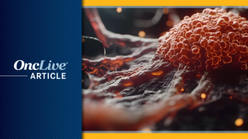 Melanoma | Image Credit: © Pter - stock.adobe.com