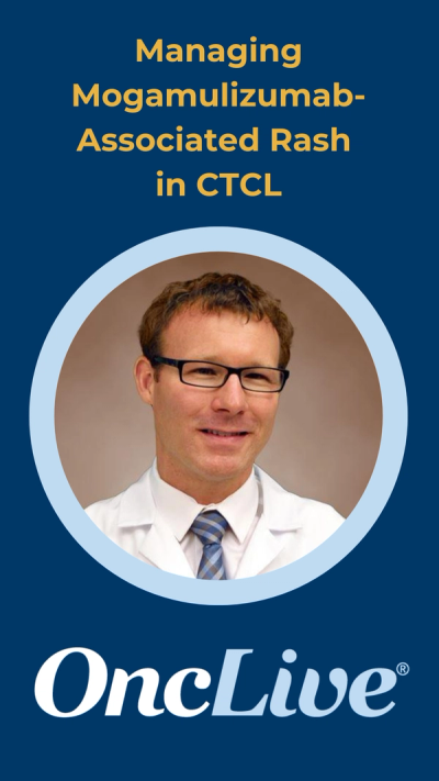 Managing Mogamulizumab-Associated Rash in CTCL