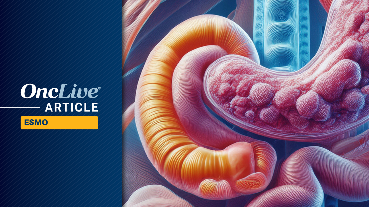 Revisit the most intriguing GI cancer data from the 2025 ESMO Congress.