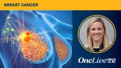 Radiation Therapy Conversations for Breast Cancer | Image Credit: © Axel Kock - stock.adobe.com