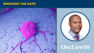 Tycel Phillips, MD, discusses considerations for navigating treatment options in relapsed/refractory mantle cell lymphoma.
