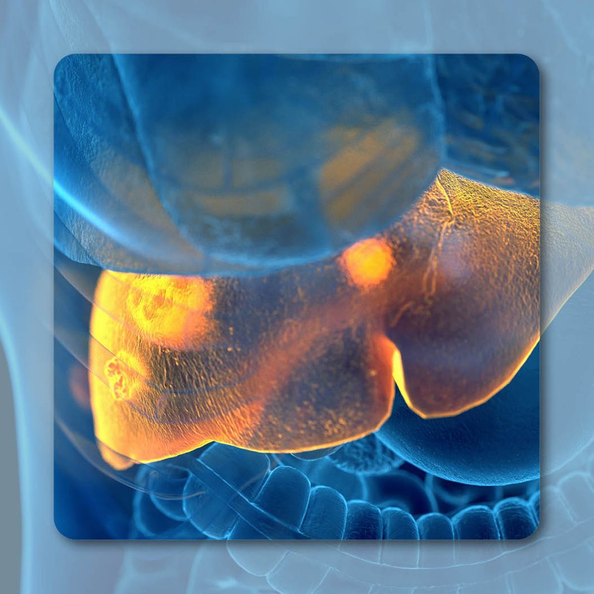 Unresectable or Advanced HCC | Image Credit: © Sebastian Kaulitzki - stock.adobe.com