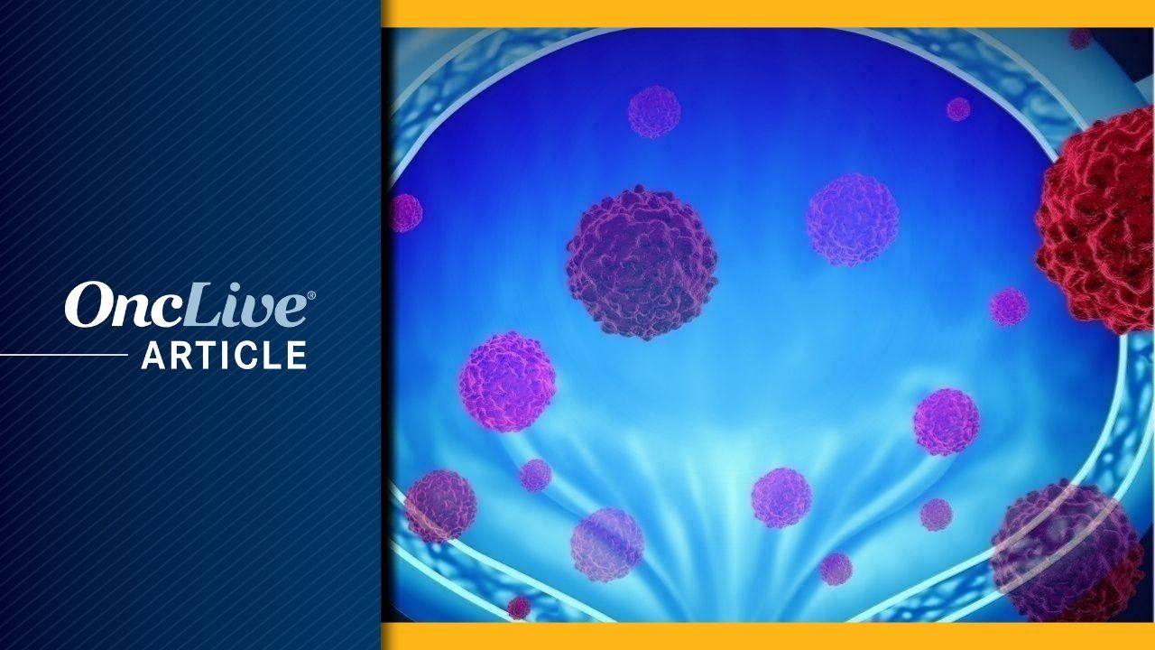 <![CDATA[ctDNA Insights Stand at the Forefront of Data-Driven, Individualized MIBC Management]]>