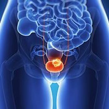 bladder cancer