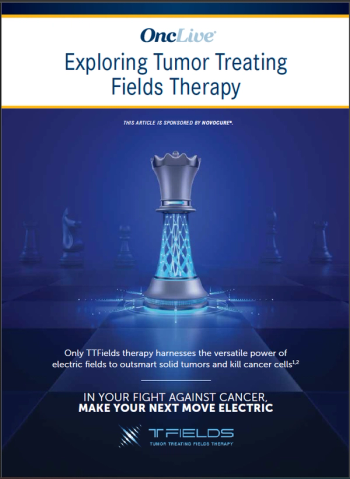 Exploring Tumor Treating Fields Therapy